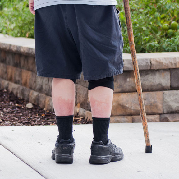 Mark, Beneficiário da Food & Care Coalition